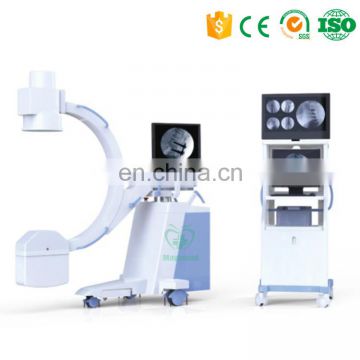 MY-D036 Mobile X Ray Machine Price High frequency c arm x ray machine