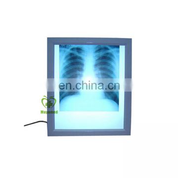 MA1148 Manufacturer wholesale x ray scanner accessories price of x-ray film