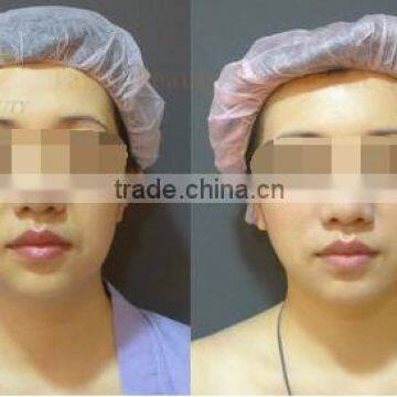 Portable Water Oxygen Deep Skin Cleaning Machine