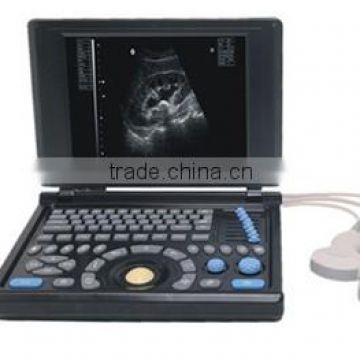 10.4 inch Ultrasonic B laptop Ultrasound Scanner with battery optional printer