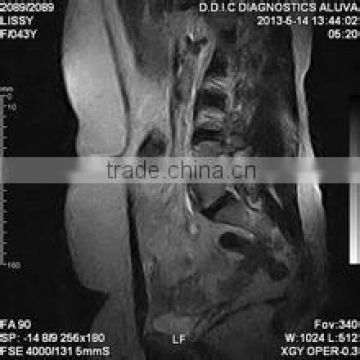 instant dental x-ray fuji dry film reader medical laser x-ray film