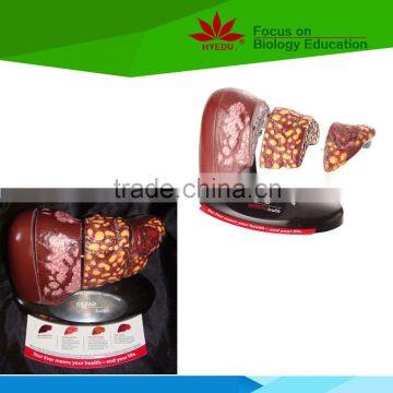 Direct factory supplied 4-stage human liver model