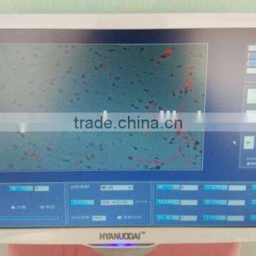 High Quality Sperm Analysis System CE Certification photo-6