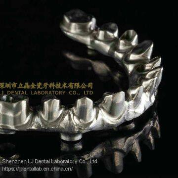 Full-arch implant bridge prosthesis, implant denture framework, implant prosthesis, laboratoire dentaire, Dentallabor, laboratorio dental, dental laboratory, Shenzhen LJ dental lab China