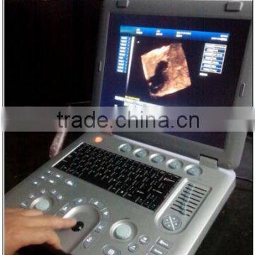(MSLCU18)3D 4D Handheld Color Doppler Medical Ultrasound Scan Machine photo-5
