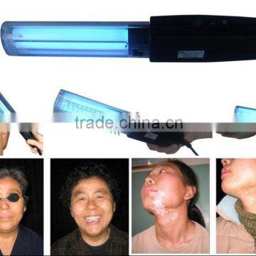 UVB therapy lamp---311nm Eczema lamp home use