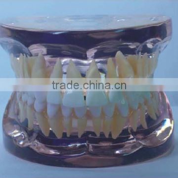 MCT-KN-017 Transparent Adult Teeth Model