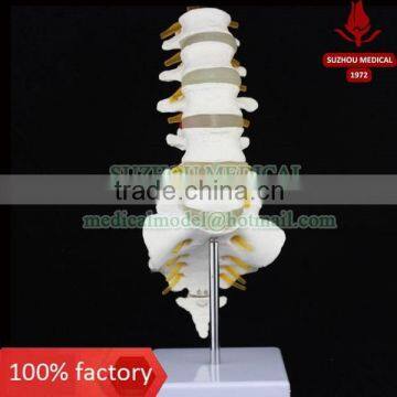 Lumbar spinal column with sacral and coccyx bones                        
                                                Quality Choice