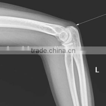 CE KND-A/F Medical thermal x ray film China