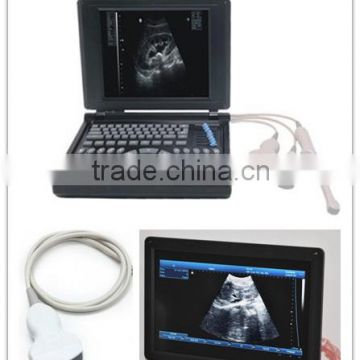 Hot model Full Digital Laptop Type Ultrasound Scanner with multi probe optional printer