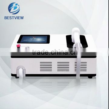 2016 Best seller 810nm Diode laser hair removal