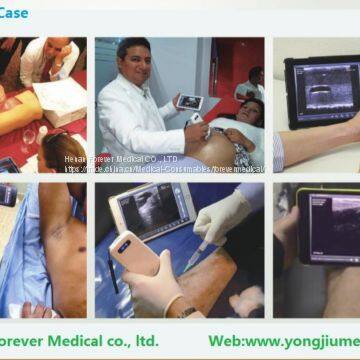 10MHz Apple Ios Android Wireless Ultrasound Probes Ultrasound Scanner photo-4