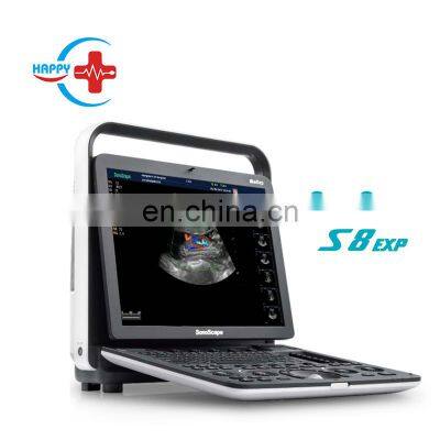 Original 3D/4D color Doppler Sonoscape Ultrasound Machine portable Sonoscape S8 EXP