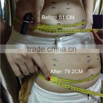 7MHZ Slimming Machine Price Ultrasound Systems/ Hifu Body Slimming Expression Lines Removal