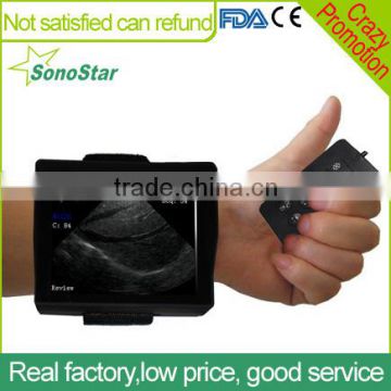 Sonostar Best Price Veterinary Ultrasound Cheapest Portable Ultrasound Machine V2