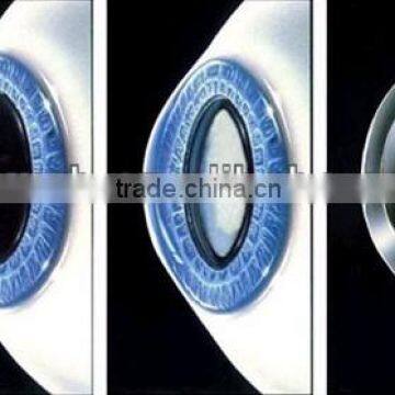 Contact lens for amblyopic treatment, Effective treatment myopic eyes