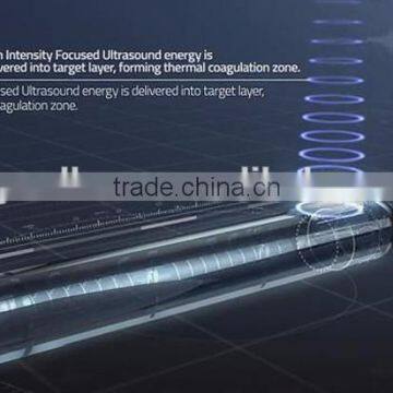 High Frequency  2017 Trending HIFU Vaginal Tightening Machine For Sale Back Tightening photo-6