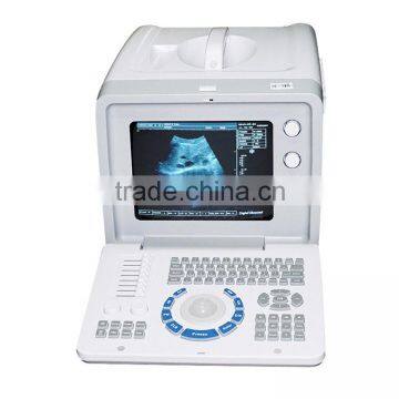 High Quality Ultrasound Machine Medical Equipment Ultrasound Machine Portable photo-3