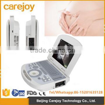 hign quality ultrasound machine with low price