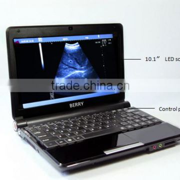 Manufatory Supply With Screen 10.1 LED portable ultrasound machine price cheaper                        
                                                Quality Choice
                                                                    Supplier's Choi