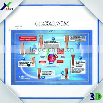 3D Plastic Medical Wall Posters, Customized 3D Anatomical Charts photo-5