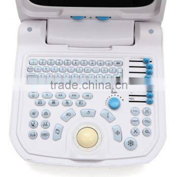 CE Approved Portable Ultrasound Scanner With 3.5Mhz Multi-frequency Convex Probe RUS-9000A photo-2