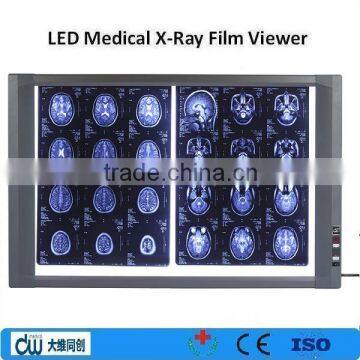 LED double medical x-ray film viewer negatoscope