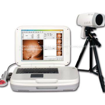 YKD-1004 Portable Infrared Breast Examination Equipment