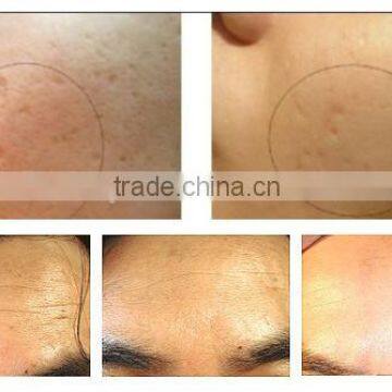 0.25mm Face Lifting 192 Titanium Micro Derma Roller Kit For Acne Scars Needle Derma Rolling System Microneedling Dermaroller photo-5