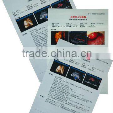 Meiqing Ultrasound Paper Film/ UPP-110HD UPP-110S UPP-110HG KP61B-CE KP91HG substitute/Medical video paper/Medical Thermal paper