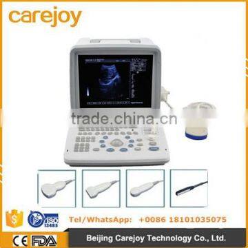 Portable Ultrasound Scanner With Convex Probe Transvaginal Micro-convex Rectal Probe Optional Video Printer