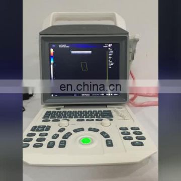 MY-A026 Medical cheap laptop high performance portable personal full digital color doppler ultrasound price