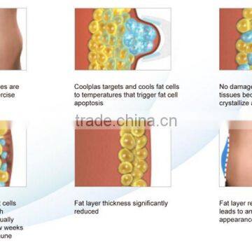 Coolplas Sincoheren Criolipolysis Body Slimming Fat Freezing Anti Cellulite Machine