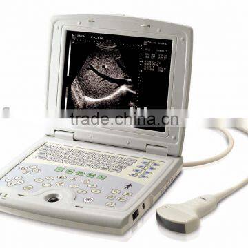 Ultrasound scanner