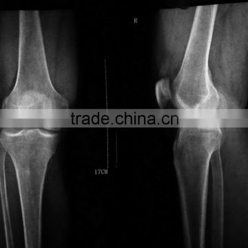 China medical x ray blue film CE KND film