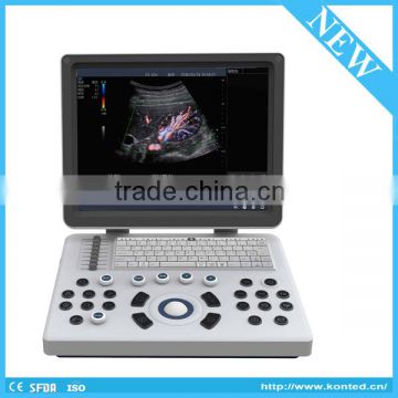 BEIJING KONTED 2016 New 3D 4D color doppler ultrasound Machine for pregnancy