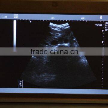 CE FDA Mark 10 Inch Laptop Veterinary / Vet Ultrasound Scanner With 3.5MHz Convex Probe Rectal With USB Port photo-3