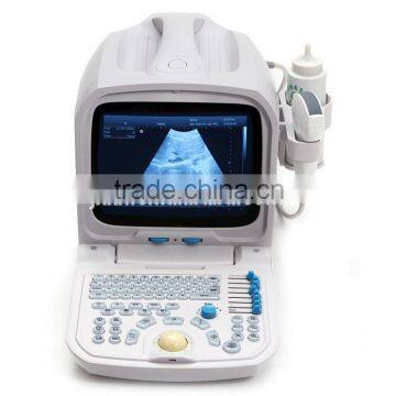 2016 High Quality Digital Portable PC Based Veterinary Ultrasound Scanner for Dog & Pig Pregnancy photo-4