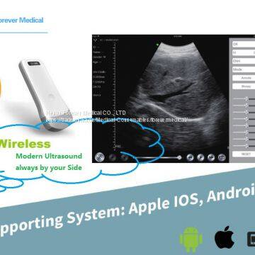 Portable Wireless Ultrasound for iPhone iPad