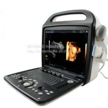 Премиумный 4D цветной допплеровский ультразвуковой сканер photo-3