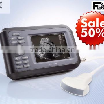 2015 new Handheld Ultrasound Scanner palm ultrasound scanner portable ultrasound scanner