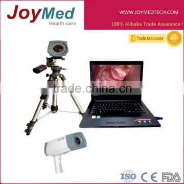 800,000pixels HD definiction laptop digital video colposcope with tripod