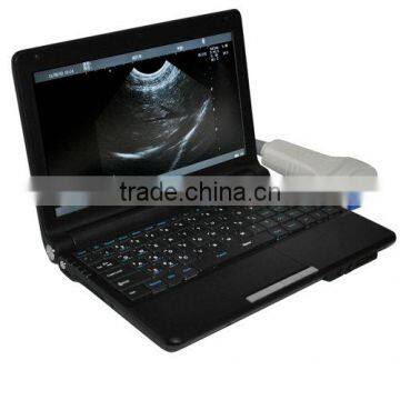Cheap Price 10 Inch Laptop Ultrasound Scanner Convex Linear Micro-convex Rectal Transvaginal Probe photo-2