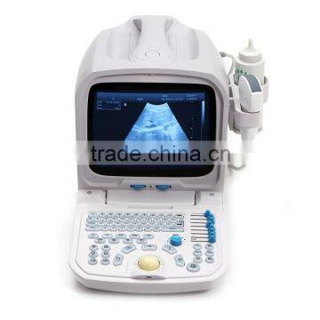 CE approved Portable Ultrasound Scanner with 3.5Mhz multi-frequency convex probe RUS-9000A