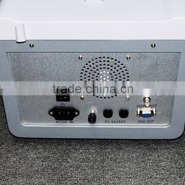Good Quality Ultrasound Scanner Portable Ultrasonic Diagnostic Machine RUS-6000D With 3.5MHz Convex Probe photo-4
