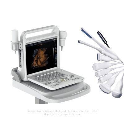 C20 Color Ultrasound Machine, Color Doppler photo-2