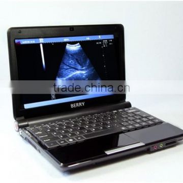 Portable Full Digital ultrasound machine with Convex Probe made in China