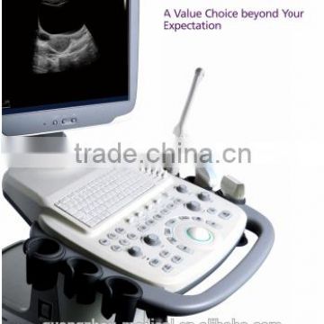 MC-DU-S11 Good Price Trolley 3D 4D General Color Doppler Ultrasound