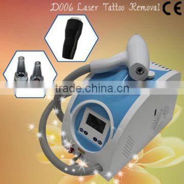 1064nm 2015 Newest Europe Hot Product Q Switch Nd Yag 532nm Laser Tattoo Removal System / Q Switch Nd Yag Laser Shr