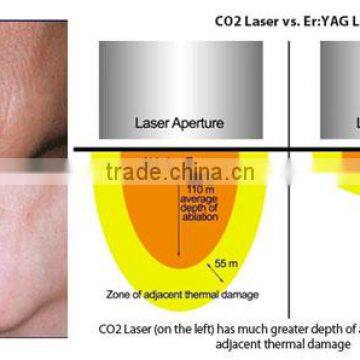 Wrinkle Removal Portable Skin Tightening Manufacturer Skin Tightening Fractional Co2 Skin Tightening Laser Equipment Co2 Laser Scar Removal Acne Treatment Remove Neoplasms photo-5